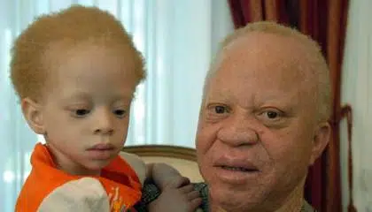 albino - Nehemiah Entrepreneurship Community